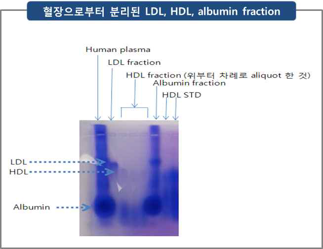 Agarose gel electrophoresis를 이용하여 혈장으로부터 분리된 LDL, HDL, albumin fraction