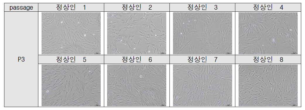 정상인 공여자 골수유래중간엽줄기세포 성상