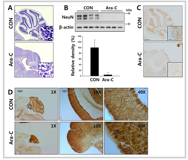 Ara-C 처리한 마우스의 소뇌부위에서 신경세포 감소 확인
