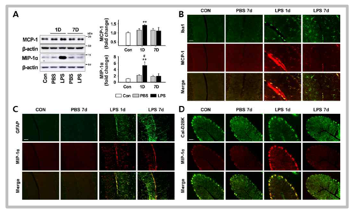 염증관련 소뇌실조증 동물모델에서 전염증성 chemokine(MCP-1과 MIP-1α)의 발현 변화와 관련세포 확인