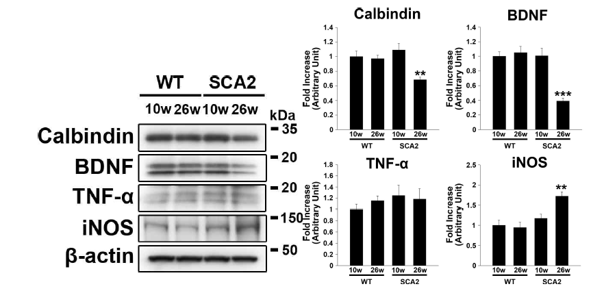 SCA2 유전자 변이 소뇌실조증 동물모델에서 염증매개인자 및 신경영양인자 발현 변화 확인