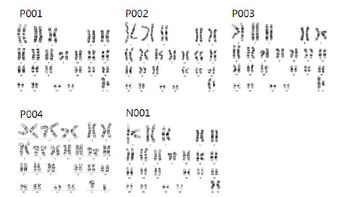 Chromosome assay를 통한 염색체 이상여부 검사