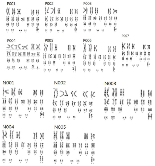 형질전환된 유도만능줄기세포의 염색체 이상 여부 검사