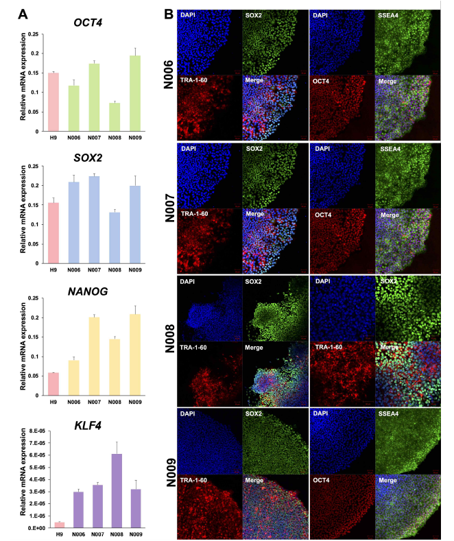 유도만능줄기세포 특성 분석. (A) Pluripotent marker 유전자 발현 (B) Pluripotent marker 단백질 발현