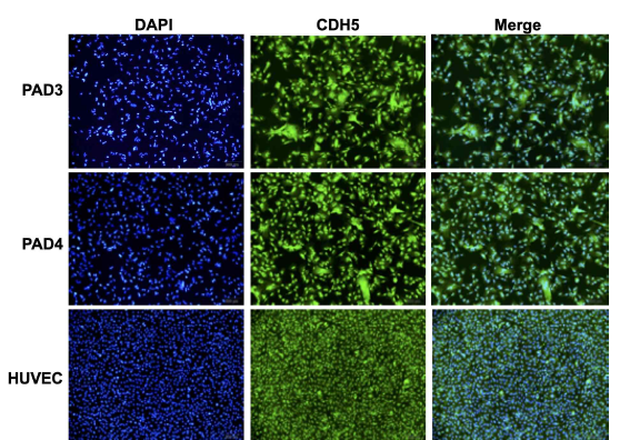 PAD-iPSC-EC의 혈관내피세포특이 마커 CDH5 단백질 발현 검사