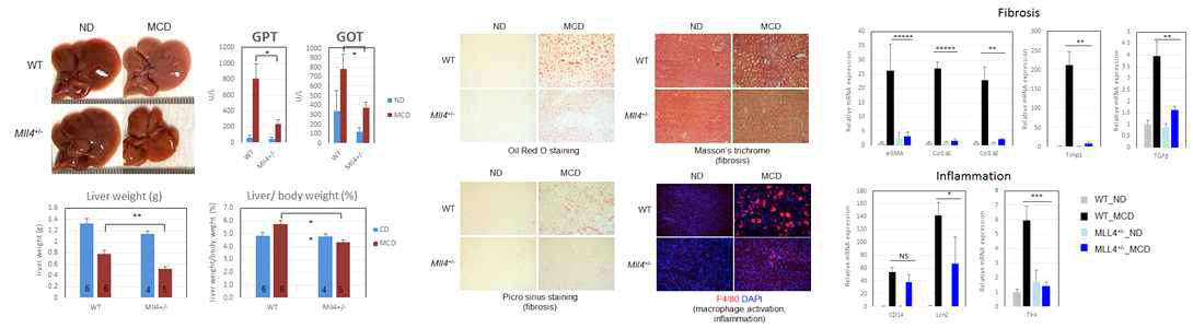 MCD diet에 의한 마우스 간 손상(NASH) 유발과 조직 염색법을 이용한 분석, 염증 및 간 섬유화 관련 유전자 발현 확인(qRT-PCR)