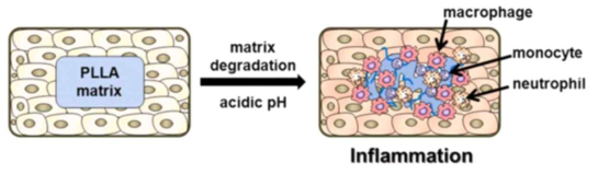 PLLA의 분해에 의한 산성환경에 따른 염증 발생 반응