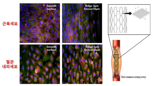 나노 패턴을 이용한 혈관 내피 세포의 선택성