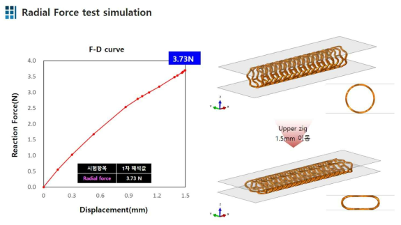 스텐트의 Radial force 시뮬레이션