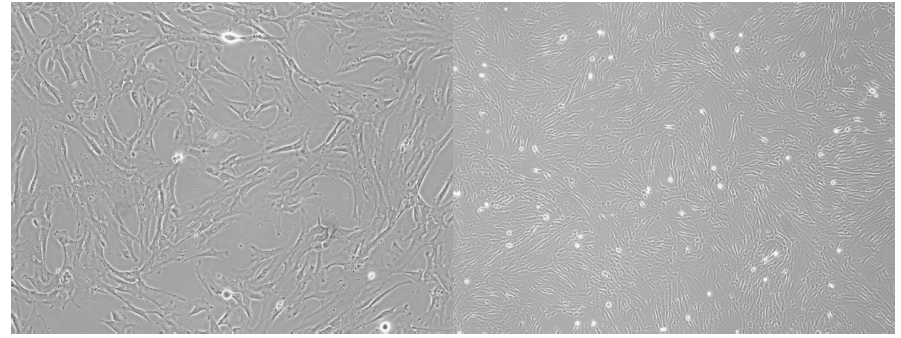 UC-MSC의 Morphology(x40, x100 배율)