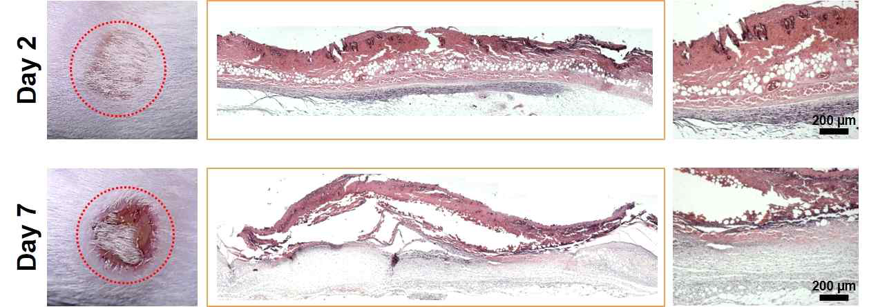 화상 창상 유도 후 2 일차와 7 일차에서의 외관 모습과 조직분석 사진