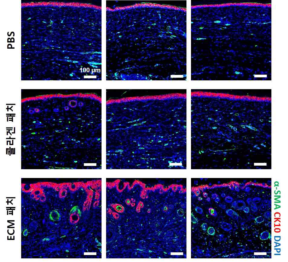 18 일차에서 재생된 조직의 면역형광염색 (α-SMA와 CK10) 사진