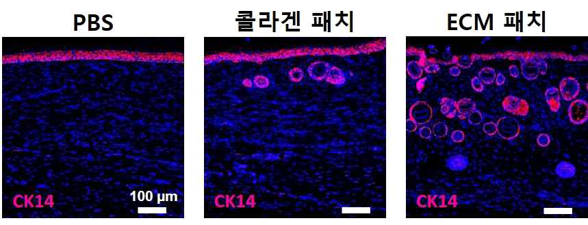 18 일차에서 재생된 조직의 면역형광염색 (CK14) 사진