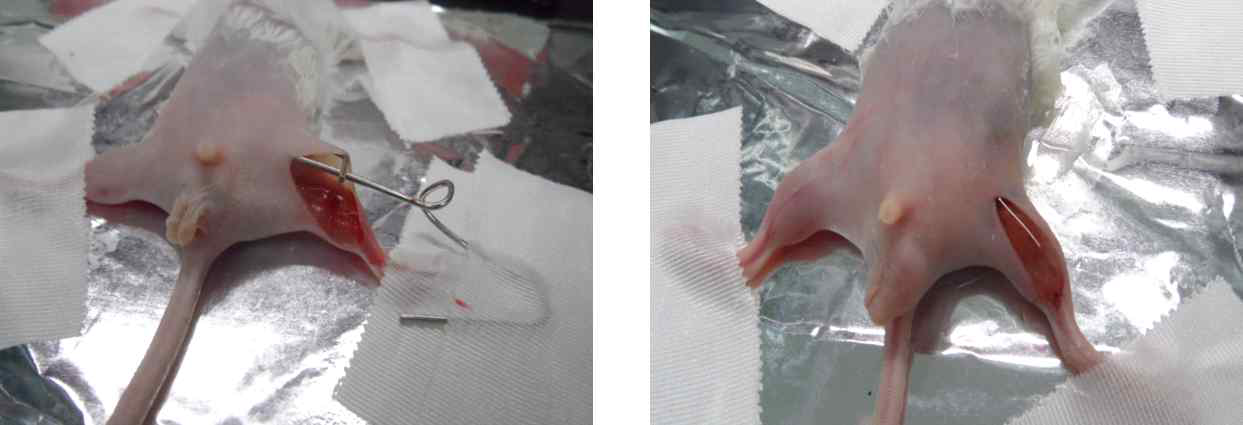 마우스의 왼쪽 다리의 혈관을 제거하여 Hindlimb ischemia model을 제작 및 ECM 패치(gel type)를 혈관을 제거한 부위에 도포한 모습