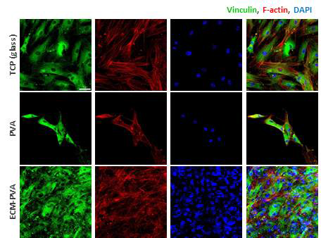 ECM/PVA 패치에 부착된 hMSCs의 세포 이미지