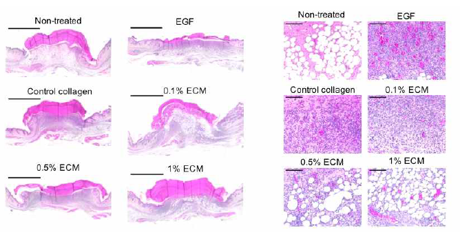 ECM 농도에 따른 재생 효능의 조직학적 평가(7일차)