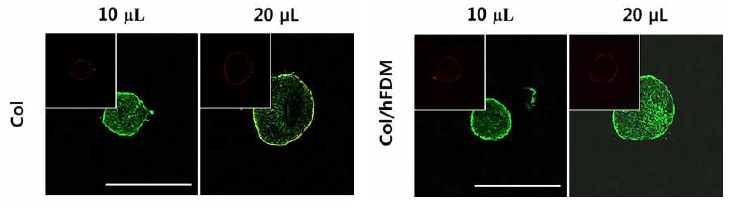 Live & dead assay를 통한 3D 스페로이드 젤의 세포생존율 평가(scale bar=10 μm)