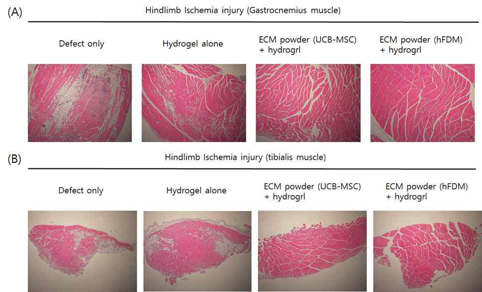 마우스의 왼쪽 다리의 gastrocnemius muscle(A)과 tibialis muscle(B)을 샘플링하여 H&E staining을 진행하여 조직 괴사를 확인