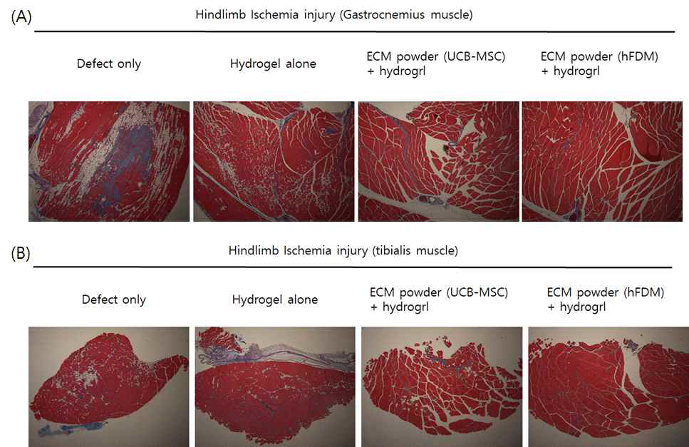 마우스의 왼쪽 다리의 gastrocnemius muscle(A)과 tibialis muscle(B)을 샘플링하여 Masson's trichrome staining을 진행하여 조직의 fibrosis를 확인