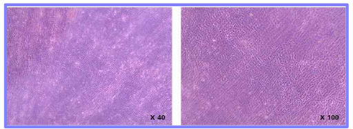 ECM-PVA matrix 가교 후 ECM의 형태 관찰