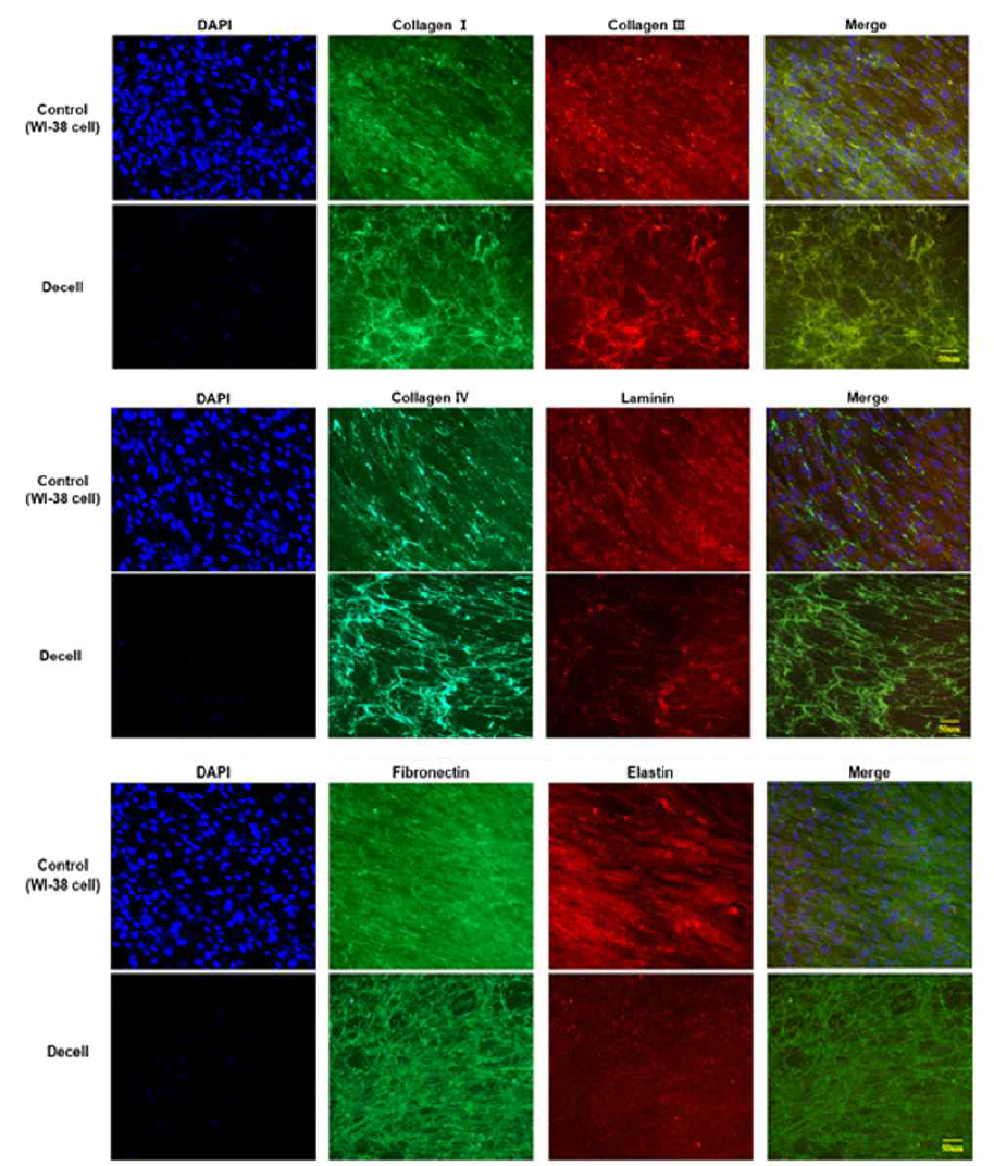WI-38 탈세포 전/후 ECM 성분 형광 염색 분석 결과