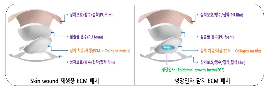 PECM 패치의 기본 구성 및 역할