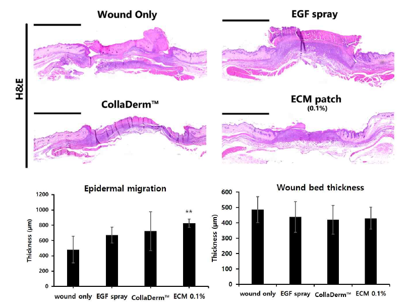 EGF spray 및 조직 유래의 CollaDerm™과 동등성 평가를 위한 이식 후 7일차 비임상 시험 조직학적 평가