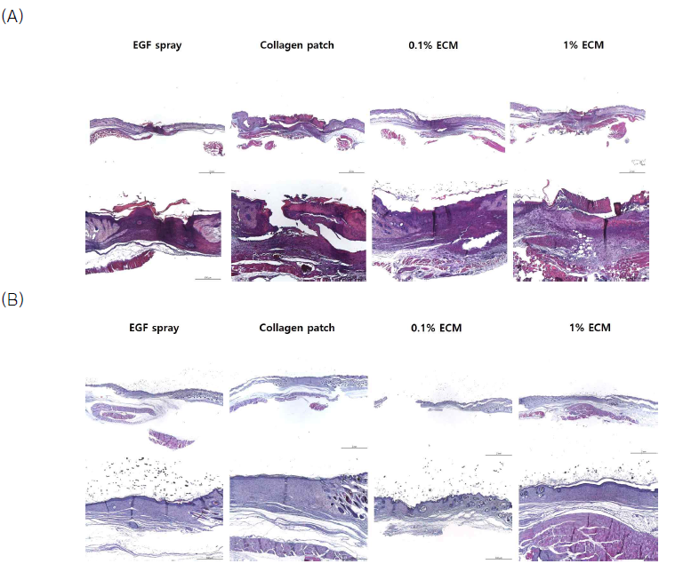 최적화 ECM 패치 선정을 위한 EGF spray와 동등성 평가를 위한 비임상 시험 조직학적 평가