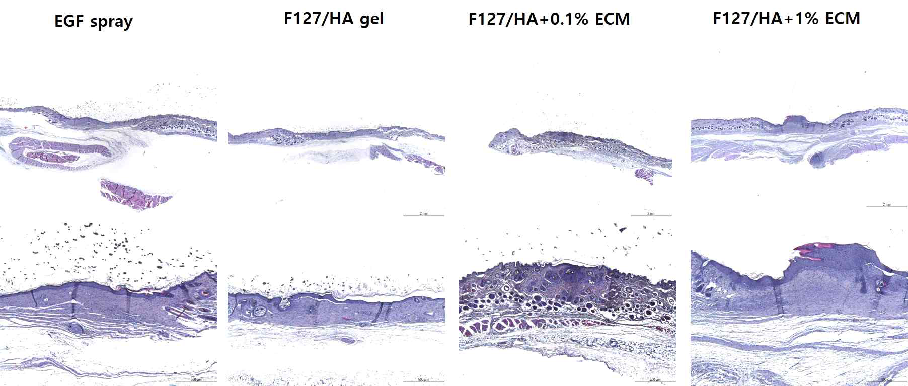 최적화 ECM gel 선정을 위한 EGF spray와 동등성 평가를 위한 비임상 시험 조직학적 평가