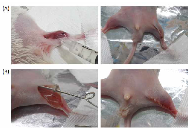 마우스의 왼쪽 다리의 혈관을 제거한 Hindlimb ischemia model에 ECM 패치를 처리하는 모습 (기존의 Injection하는 모습(A), 기존의 위치보다 아래쪽을 절개하여 ECM 패치(gel type)를 처리하여 처리한 부위를 덮어주는 방식으로 봉합하여 ECM 패치(gel type)의 손실을 최소화한 사진)