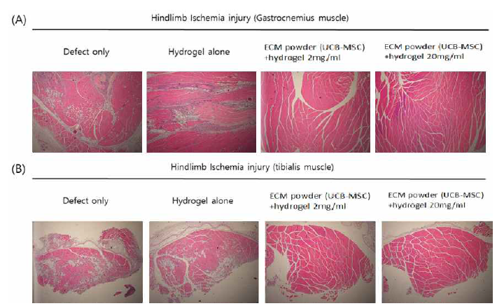 마우스의 왼쪽 다리의 gastrocnemius muscle(A)과 tibialis muscle(B)을 샘플링하여 H&E staining을 진행하여 조직 괴사를 확인