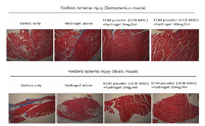 마우스의 왼쪽 다리의 gastrocnemius muscle(A)과 tibialis muscle(B)을 샘플링하여 Masson's trichrome staining을 진행하여 조직의 fibrosis를 확인