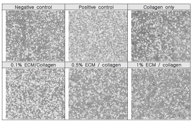 ECM/Collagen matrix 세포독성 morphology 결과