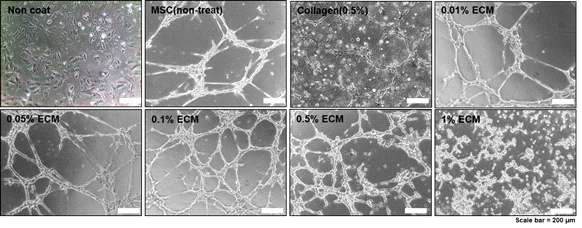 Tube formation 형성 이미지 결과