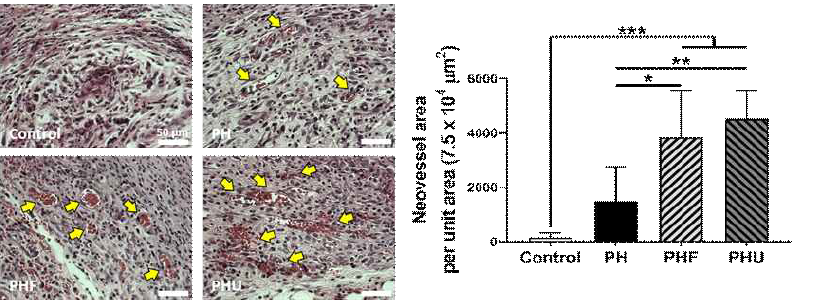 재생된 조직내 (7 일차) 신생혈관 사진과 재생된 신생혈관의 면적에 대한 정량적 그래프