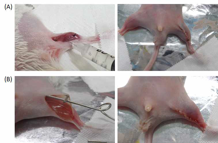 (A) 마우스의 왼쪽 다리의 혈관을 제거한 Hindlimb ischemia model에 ECM 패치(gel type)를 기존의 Injection하는 모습, (B) 기존의 위치보다 아래쪽을 절개하여 ECM 패치(gel type)를 처리하여 처리한 부위를 덮어주는 방식으로 봉합하여 ECM 패치(gel type)의 손실을 최소화한 사진