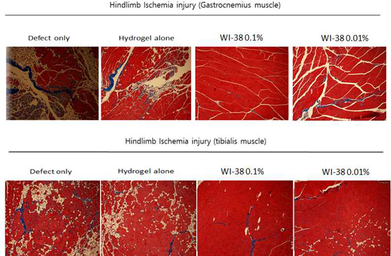 마우스의 왼쪽 다리의 gastrocnemius muscle(A)과 tibialis muscle(B)을 샘플링하여 Masson's trichrome staining을 진행하여 조직 fibrosis를 확인