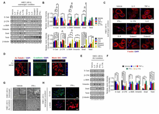 IFN-g induced epithelial-to-mesenchymal transition (EMT) in human nasal epithelial cells (hNECs)