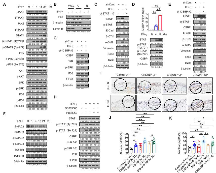 p38, ERK signaling is crucial for IFN-g-induced EMT in hNECs and is activated in patients with neutrophilic NE-NP