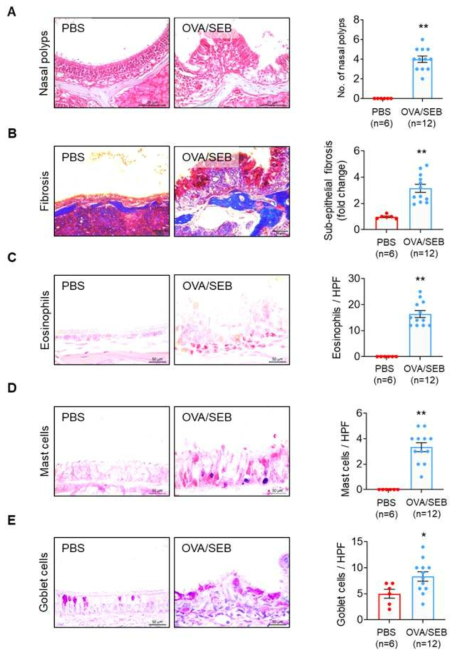 Histopathological evaluation of nasal mucosal tissue