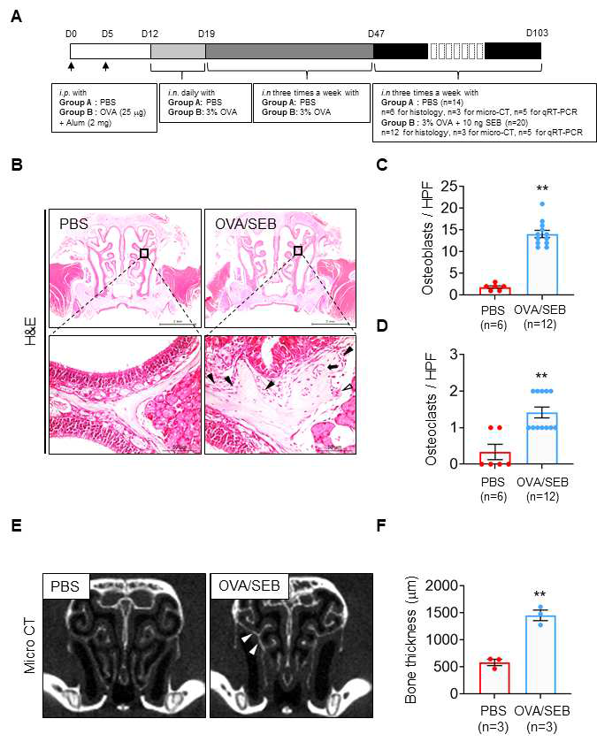 Establishment of eosinophilic CRS with neo-osteogenesis murine model