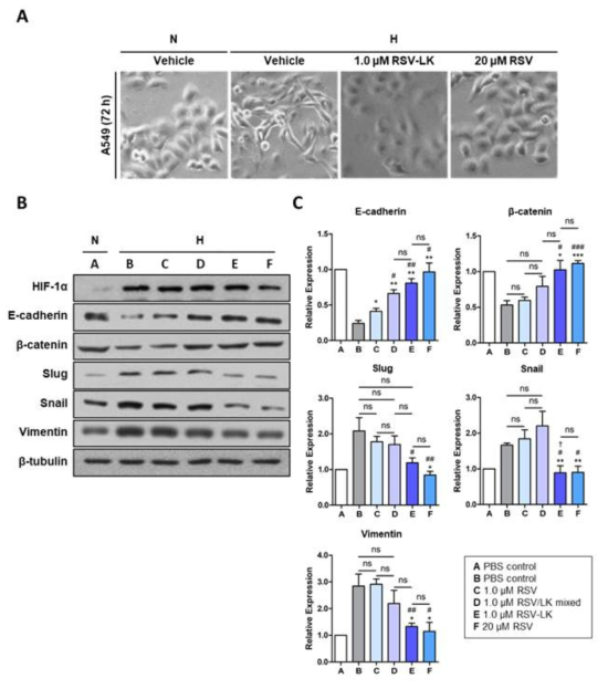 In vitro inhibitory effect of RSV-LK on hypoxia-induced EMT