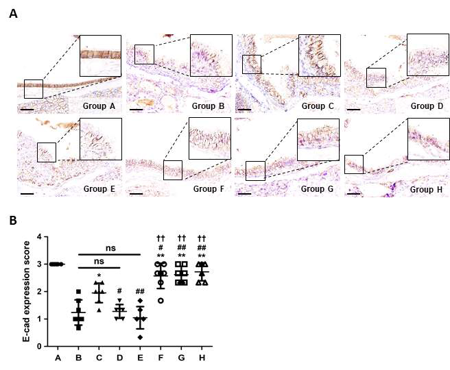 In vivo efficacy of RSV-LK on the recovery of the E-cadherin expression