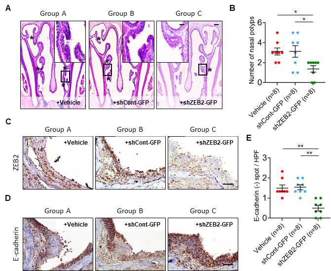 ZEB2 knockdown diminishes HDM/DEP-induced nasal polypoid lesions