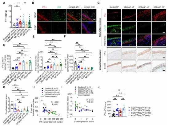 Upregulation of interferon (IFN)-g and reciprocal expression with E-Cad in patients with neutrophilic non-eosinophilic (NE) chronic rhinosinusitis with nasal polyps (CRSwNP).