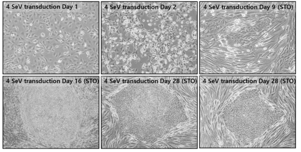 센다이바이러스를 이용한 역분화 줄기세포 확립 과정