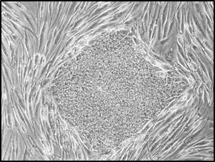 센다이 바이러스를 이용하여 역분화줄기세포를 수립하였음. (transduction 후 28 일)