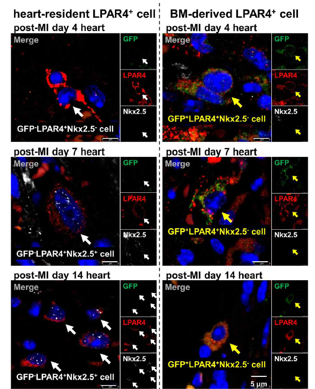 마우스 심근경색 4, 7, 14 일차 LPAR4 양성세포에서 Nkx2.5 발현