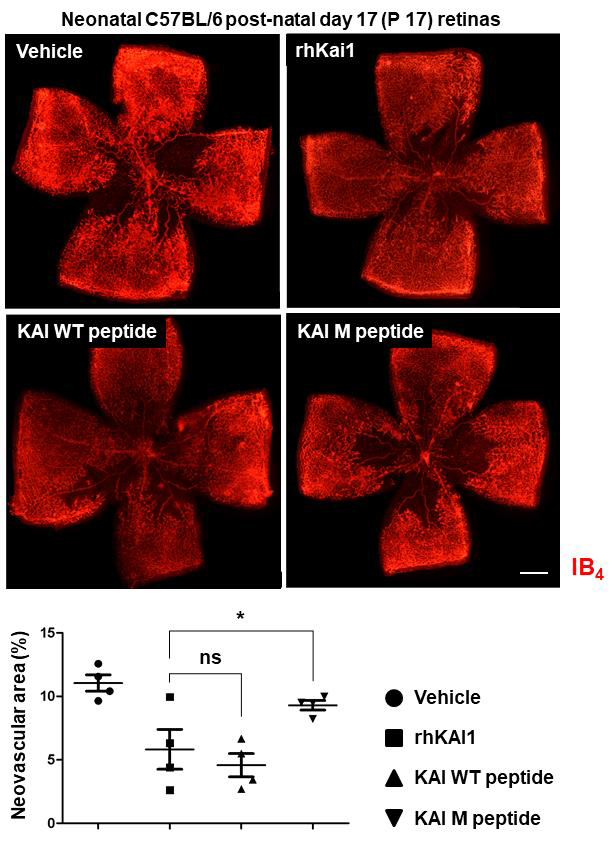 KAI1 recombinant protein과 peptide가 망막병증 동물 모델에서 혈관신생을 억제함