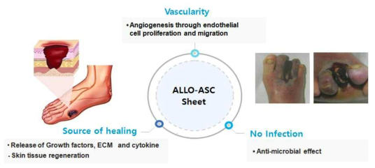 ALLO-ASC-Sheet의 당뇨병성족부궤양 치료 기전